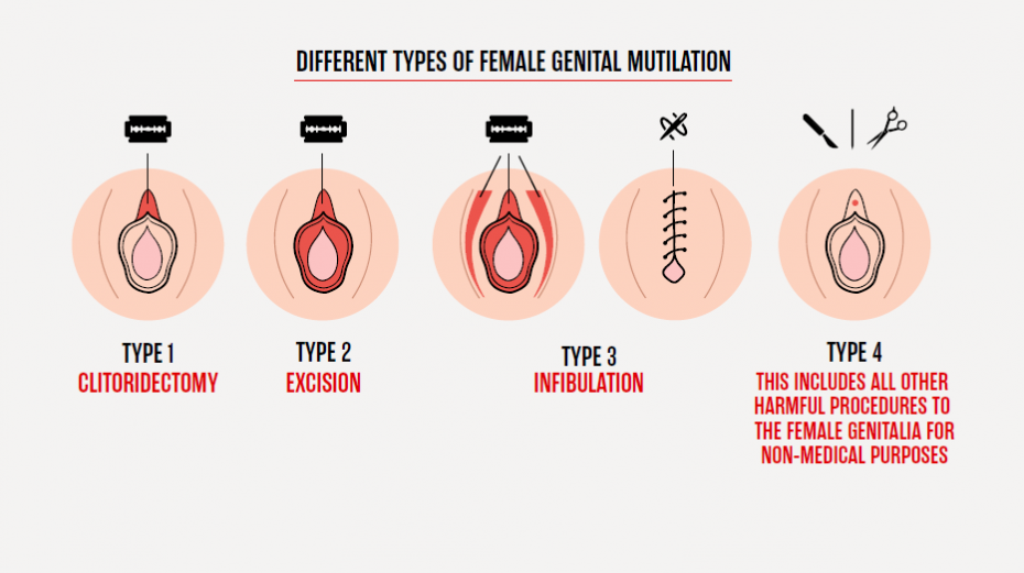 Female Genital Mutilation